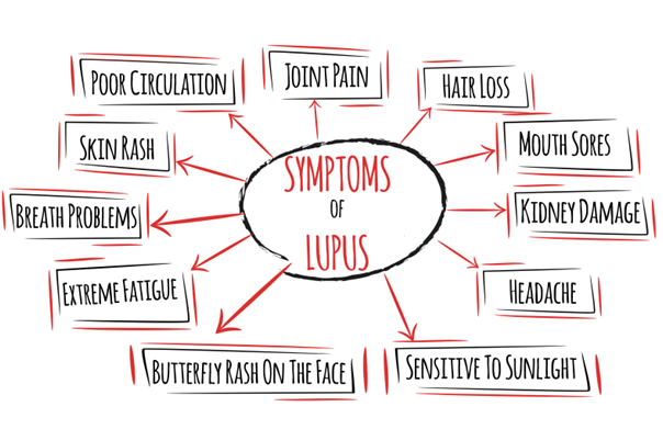 Managinglupus-(1).png Managinglupus-(1).png
