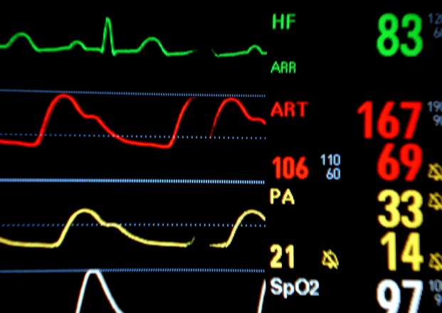 Monitoring