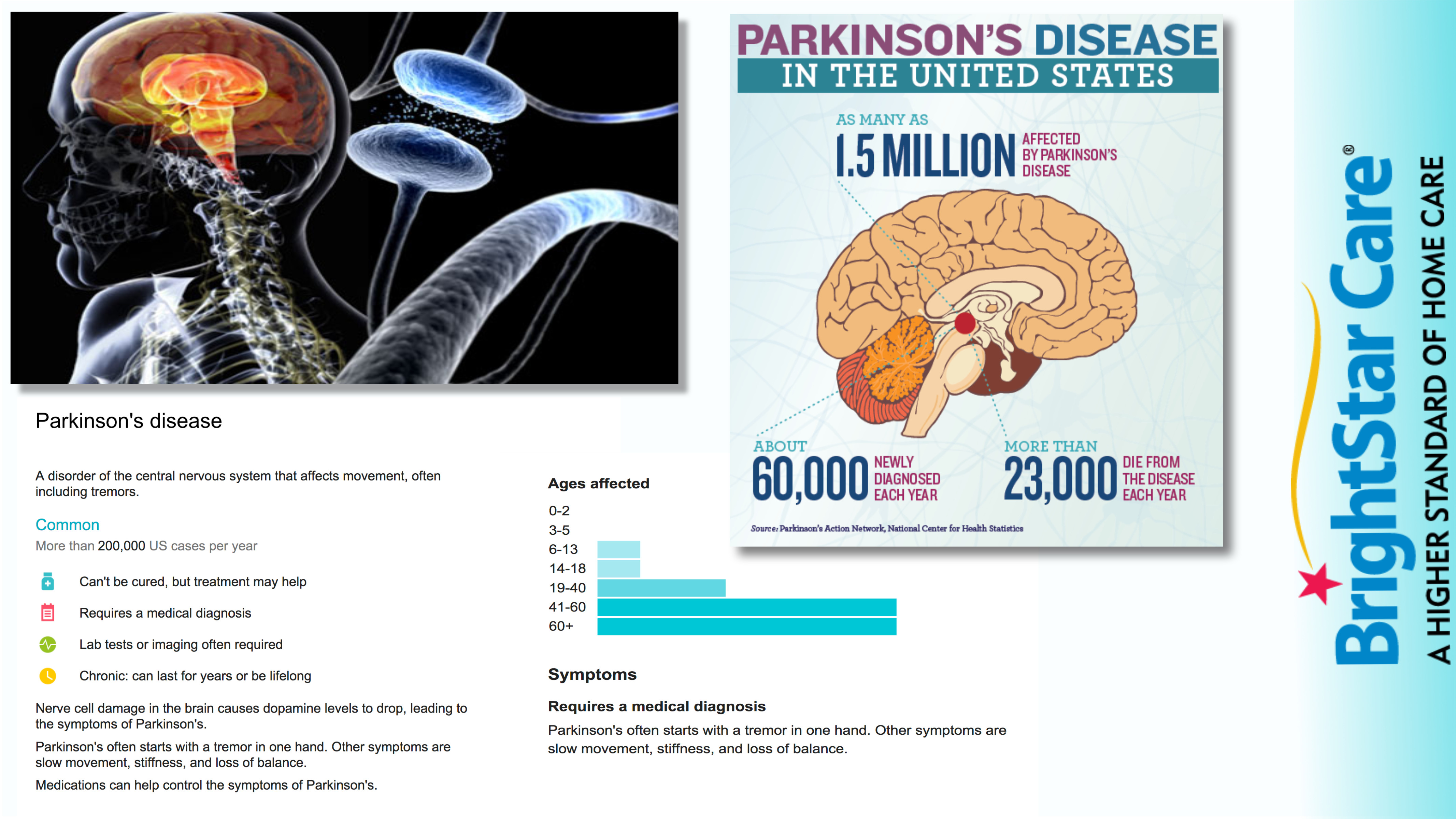 Quick Facts about Parkinson's Disease
